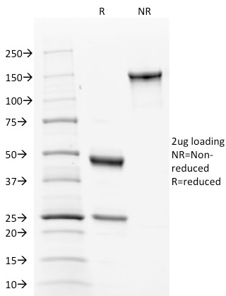 Data from SDS-PAGE analysis of Anti-Calnexin antibody (Clone CANX/1543). Reducing lane (R) shows heavy and light chain fragments. NR lane shows intact antibody with expected MW of approximately 150 kDa. The data are consistent with a high purity, intact mAb.